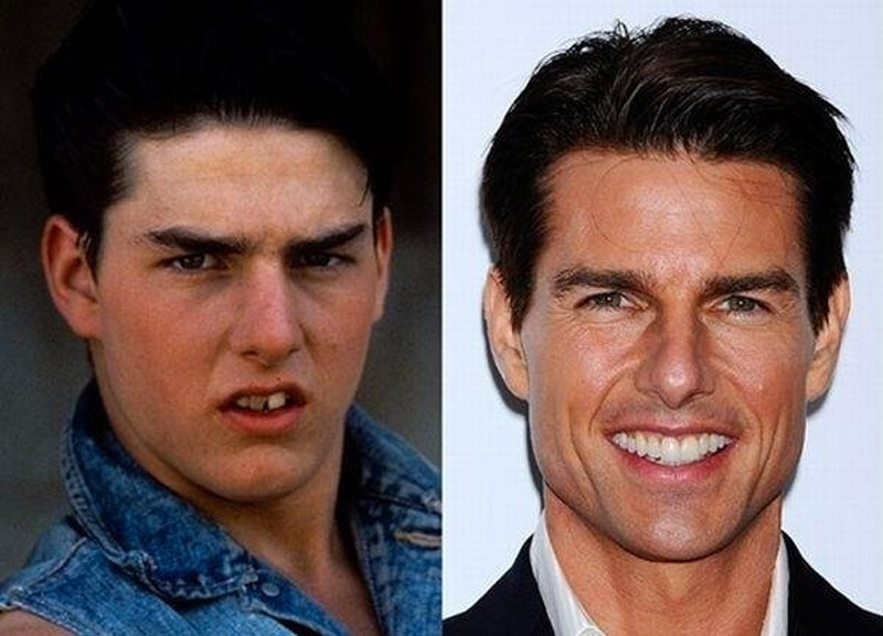 Tom Cruise antes y después de tener dinero